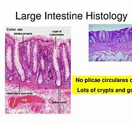 Image result for Large Intestine Histology Slides