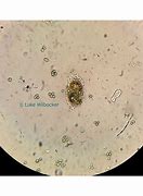 Image result for Amoeba Under Microscope 100X