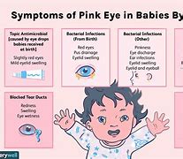 Image result for Pink Eye in Children