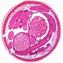 Image result for lumbricoides