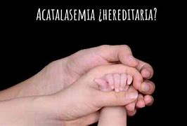 Image result for acasemia