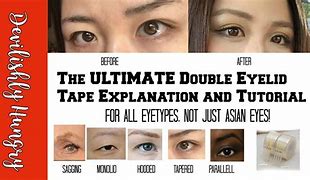 Image result for Double Eyelid Types