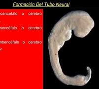Image result for 0ntogenia