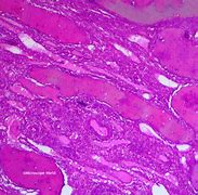 Image result for Ovary Microscopic View