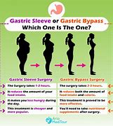 Image result for Rue En Y Gastric Bypass