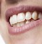 Image result for Smile Teeth