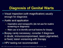 Image result for HPV Wart Removal
