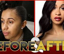 Image result for Cardi B Surgery