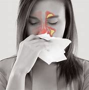 Image result for Women Sneezing From Allergies