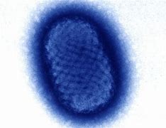 Image result for Orf Virus Human
