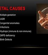 Image result for Intrauterine Fetal Demise and DIC PPT