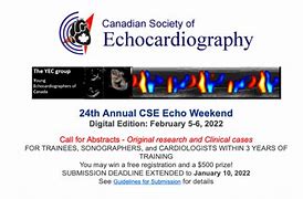 Image result for scecho