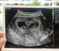 Image result for 9 Weeks Pregnant Belly Second Pregnancy