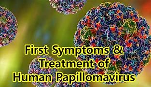 Image result for Human Papillomavirus Infection Elbow