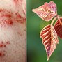 Image result for Poison Ivy Berries and Flowers