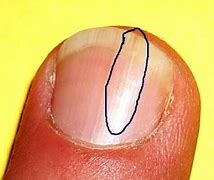 Image result for 1 4 Inch Fingernails