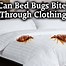 Image result for Bed Bugs On Clothes