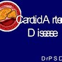 Image result for Carotid Artery Stenosis