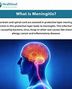 Image result for Meningitis