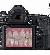 Image result for Dental Sony A7 Photography