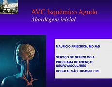 Image result for isqu�mico
