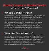 Image result for NIH Genital Warts