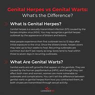 Image result for Female Wart Genital Herpes