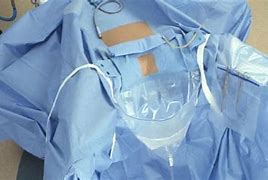 Image result for Drape Clips Surgery