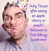 Image result for Oral Allergy Syndrome List