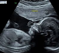 Image result for Ultrasound Side Profile