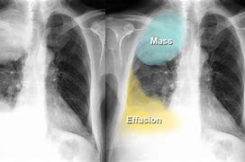 Image result for What Does Mass Look Like