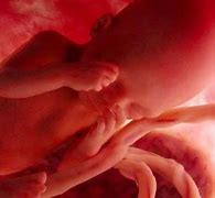 Image result for feto