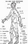 Image result for Acupuncture Healing