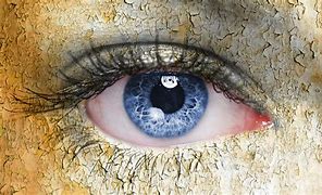 Image result for Ocular Surface Disorders and Scleral Lens
