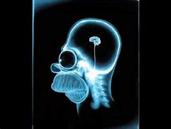 Image result for Brain Scan Funny