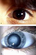 Image result for Camera Lens Anomalies