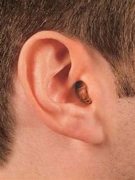 Image result for Invisible OTC Hearing Aids