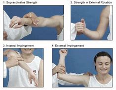 Image result for Rotator Cuff Physical Exam