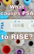 Image result for Sharp Rise in PSA
