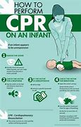 Image result for When to Perform CPR