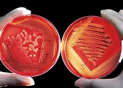 Image result for Proteus Nutrient Agar