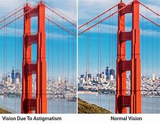 Image result for Astigmatism Photography