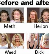 Image result for Marijuana Before and After