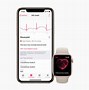 Image result for Apple Watch with ECG and Oxygen Sensor