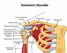Image result for Swimmer Shoulder Impingement