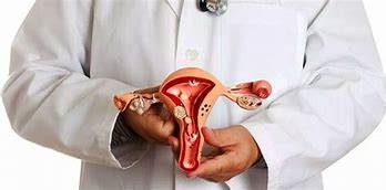 Image result for Adnexal Cyst Causes