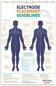 Image result for Tens Unit Pad Placement Chart