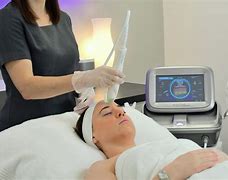 Image result for RadioFrequency MicroNeedling