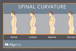 Image result for Normal Spine Curve