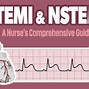 Image result for STEMI vs NSTEMI ECG